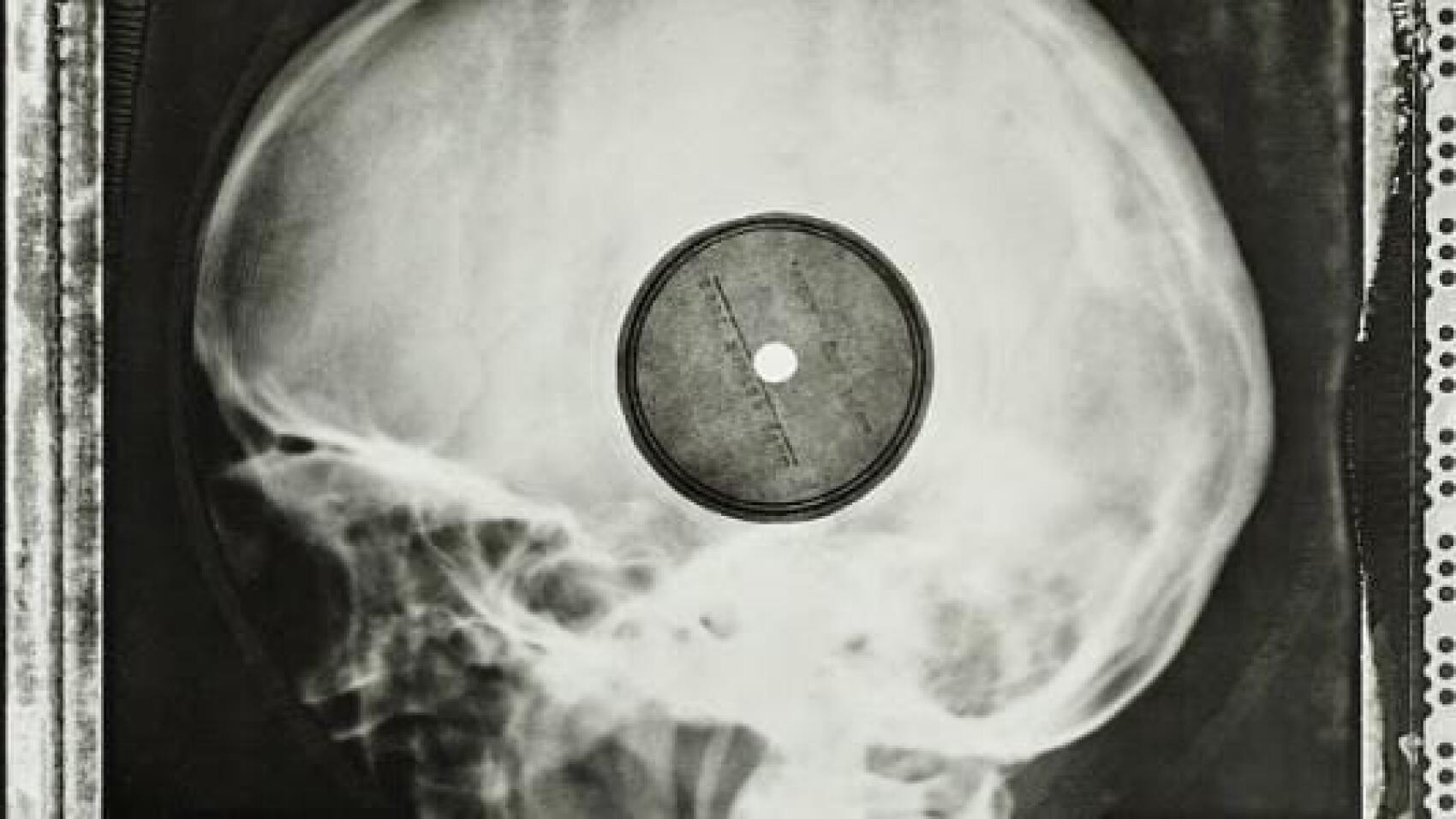 Contre la censure : des vinyles sur radio