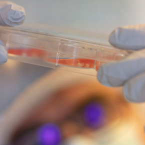 Mini cerveaux © Romain Guittet