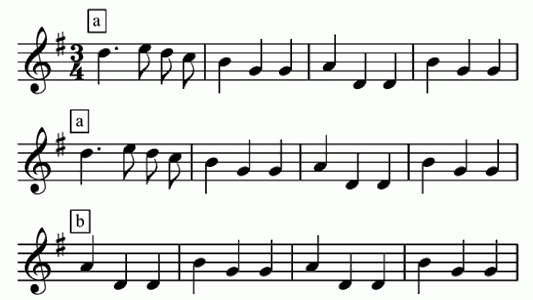 Pourquoi aimonsnous la répétition en musique ? Radio Nova